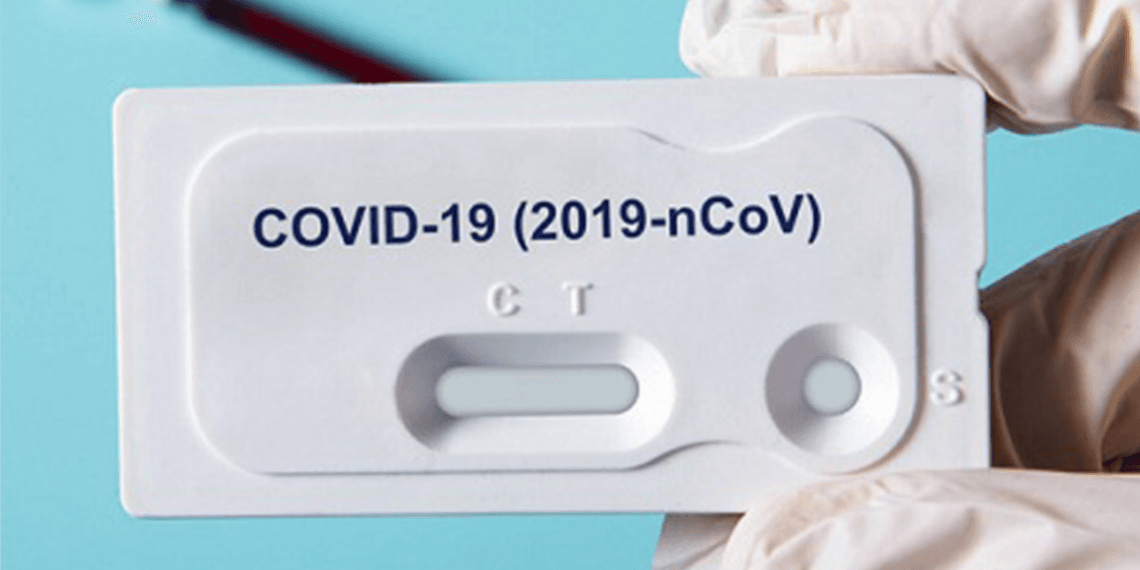 სად შეგიძლიათ ჩაიტაროთ ტესტი კოვიდ19-ზე ქუთაისში