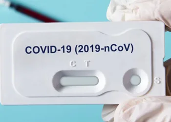 სად შეგიძლიათ ჩაიტაროთ ტესტი კოვიდ19-ზე ქუთაისში