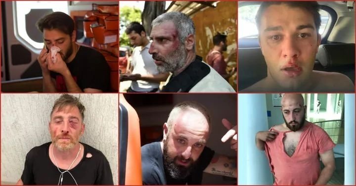  კოალიცია “მედიის ადვოკატირებისათვის”  პარტნიორი ორგანიზაციები მზად არიან სამართლებრივი დახმარება გაუწიონ 2021 წლის 5 ივლისს დაზარალებულ მედიის წარმომადგენლებს