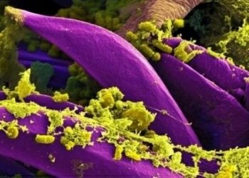 მეცნიერებმა ჭირის საწინააღმდეგო ახალი  ვაქცინა დაამზადეს