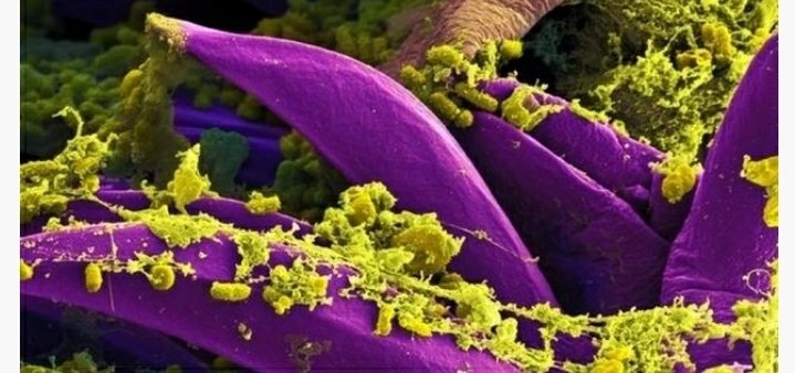 მეცნიერებმა ჭირის საწინააღმდეგო ახალი ვაქცინა დაამზადეს