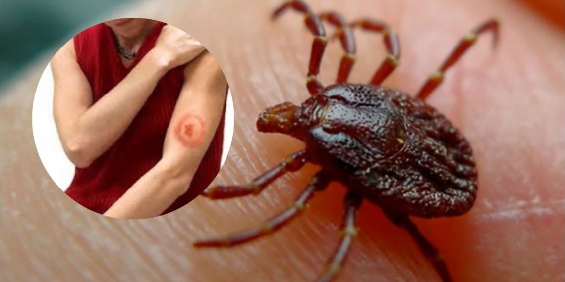 ასპინძაში ყირიმ-კონგოს ვირუსი 3 ადამიანს დაუდასტურდა