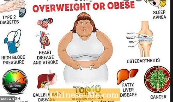 სიმსუქნე იწვევს კიბოს, უნარშეზღუდულობისა და სიკვდილის ერთ-ერთი მთავარი მიზეზია