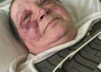 70 ქალს ოკუპანტებმა ხერხემალი პასპორტის არდათმობის გამო გაუტეხეს