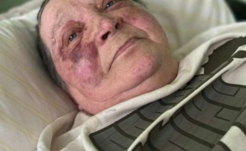 70 ქალს ოკუპანტებმა ხერხემალი პასპორტის არდათმობის გამო გაუტეხეს