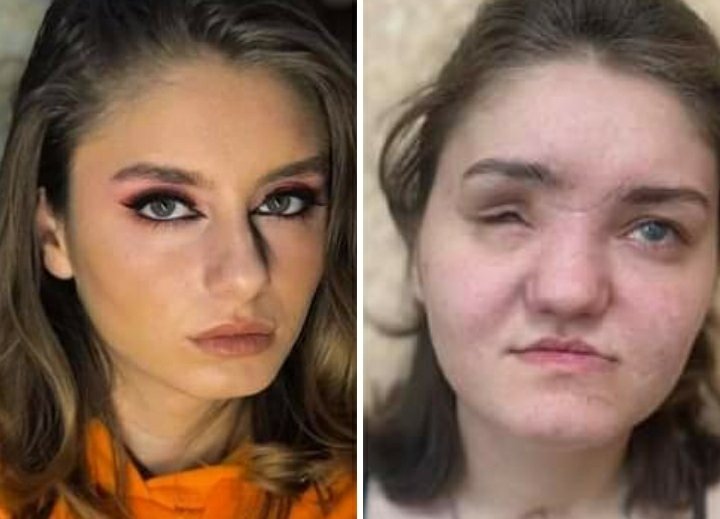 ერთი წლის განმავლობაში მარიამს ჩაუტარდა 6-ზე მეტი ოპერაცია