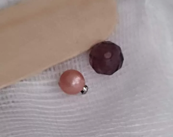 3 წლის ბავშვი კლინიკაში ცხვირში შეტანილი მძივების ბურთულებით შეიყვანეს