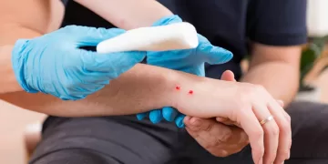 როგორ უნდა მოიქცეთ თუ გველმა გიკბინათ