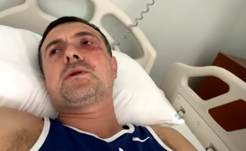 40ზე მეტი ადამიანი მოვარდა, დაანგრიეს ყველაფერი, დღეს უფრო ვერ ვარ კარგად – ირაკლი ეძგვერაძე