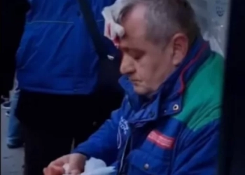 სახლიდან შუშა ჩამოვარდა და კონტროლიორს დაეცა