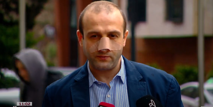 იაგო ხვიჩიას თავს დაესხნენ