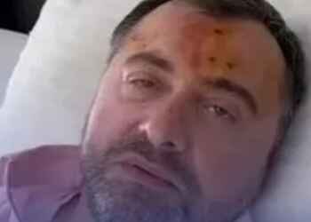 ტვინის შერყევა მაქვს, ასევე ბევრ ადგილას დაჟეჟილობა-გია ჯაფარიძე