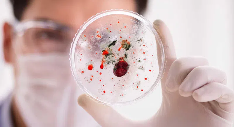 სალმონელოზის გამოვლენის გამო სეს-მა მოკვლევა დაიწყო