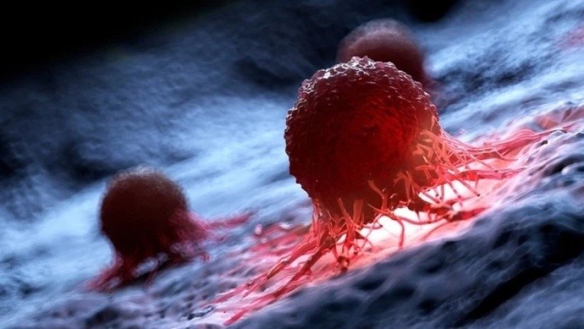 ექვსი ფაქტორი, რომელიც ხელს უწყობს ახალგაზრდებში სიმსივნის განვითარებას – ახალი კვლევა