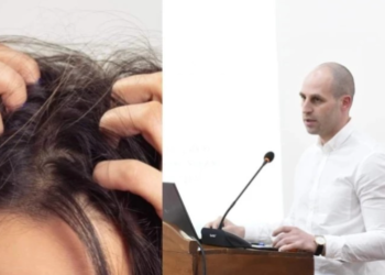 თუ სკალპის ქავილი გაწუხებთ, ნახეთ სავარაუდო დიაგნოზი