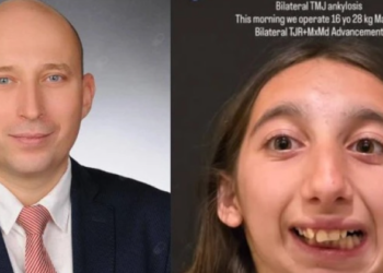 ვინ არის თურქი ექიმი, ვინც ქართველ გოგონას ყბა-სახის ოპერაცია გაუკეთა