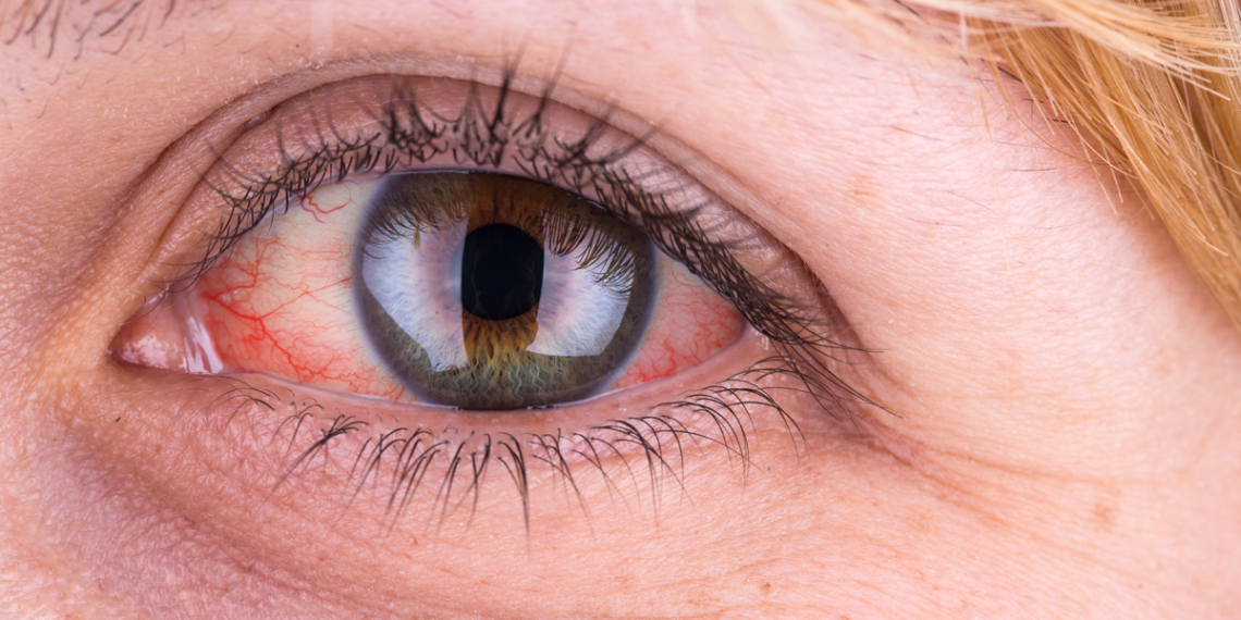 დასახელდა საკვები, რომელიც თვალის ჯანმრთელობას ზიანს აყენებს