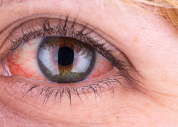 დასახელდა საკვები, რომელიც თვალის ჯანმრთელობას ზიანს აყენებს