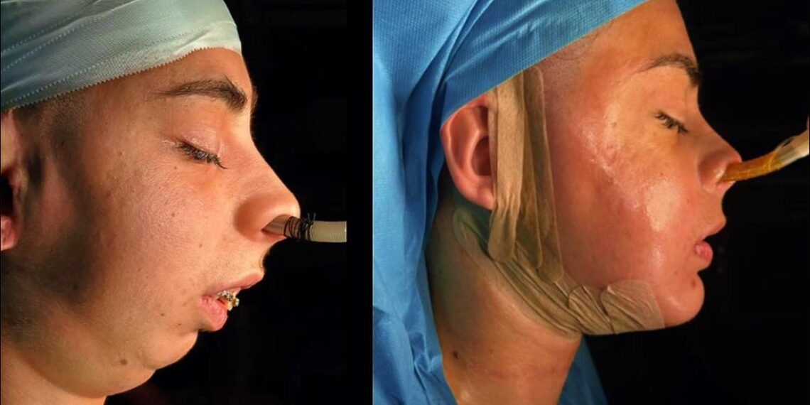 თურქი ექიმის კიდე ერთი სასწაული – „დანტესი“ პირველ ფოტოებს აქვეყნებს