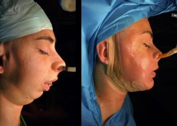 თურქი ექიმის კიდე ერთი სასწაული – „დანტესი“ პირველ ფოტოებს აქვეყნებს