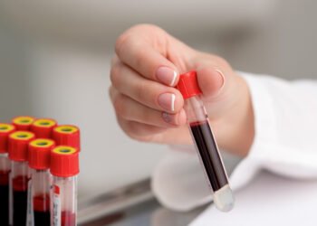 „თუ ეს სიმპტომი გაქვთ, სისხლის ანალიზი აიღეთ“ – ექიმი საზოგადოებას მიმართავს