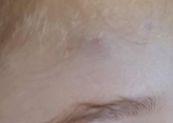 “მიხედეთ წყალტუბის მაფიოზებს” – მშობელი ბავშვის ცემის ფაქტზე საუბრობს