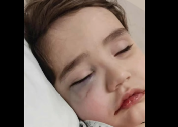 პატარა დაჩის საზოგადოების დახმარება სჭირდება