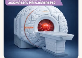 თავის ტვინის ანევრიზმის სკრინინგი ქუთაისში